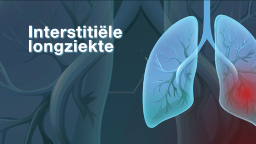 Interstitiële longziekte